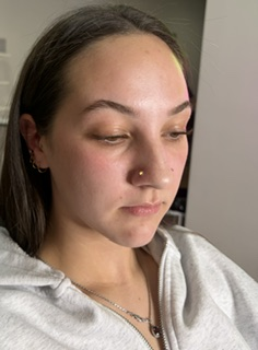 Fresh nose piercing — healing perfectly with proper aftercare.
