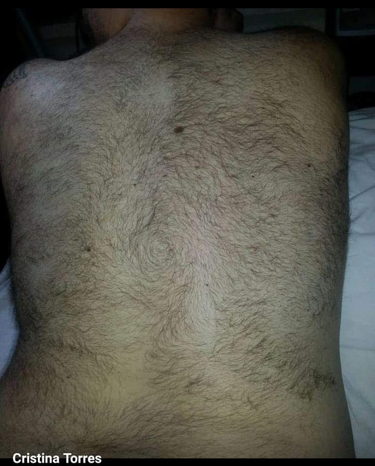 Client's back before waxing — full hair coverage.